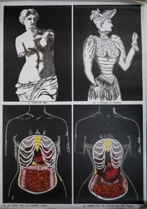 Poster showing the effect of corsets on the human body